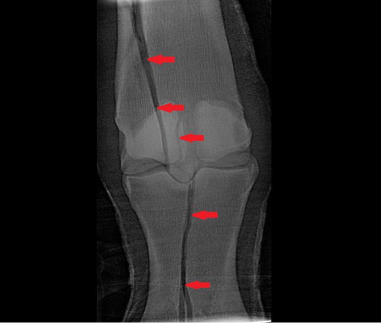 Fracture Repair Surgery Weston Davis Equine Surgery